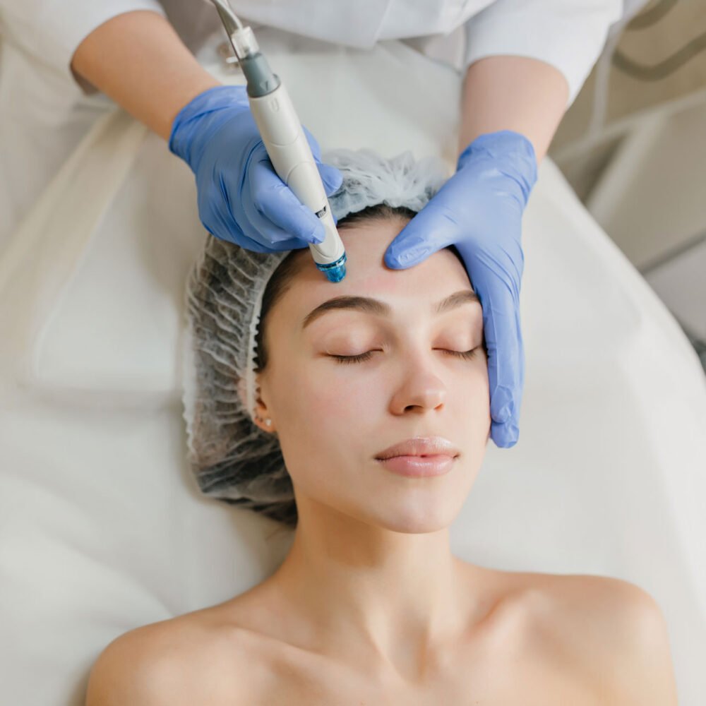 Dermapen - 1 sesión